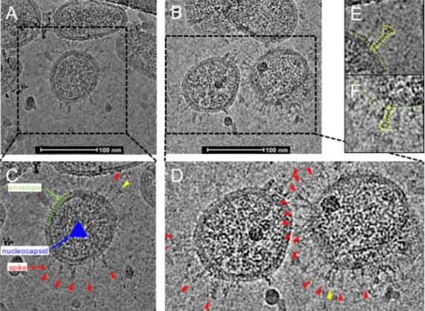 伯能滅菌器助力防“疫”在行動(dòng)(圖2) 伯能滅菌器助力防“疫”在行動(dòng)(圖2)